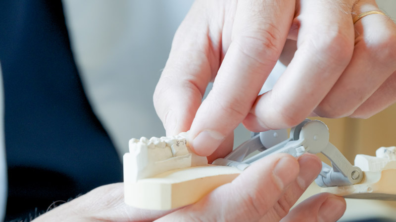 Cadillac Mi Dental Bonding Dentist